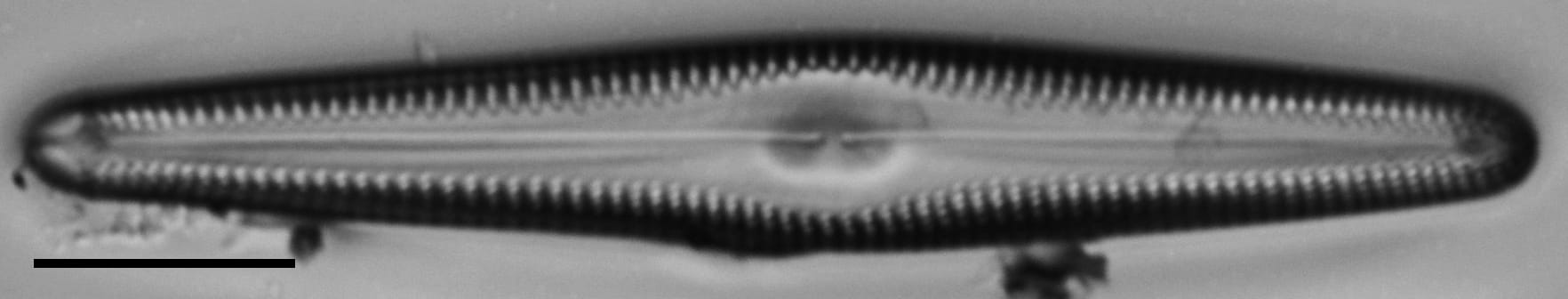 Gomphonema christenseni LM2