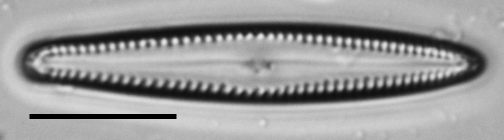 Gomphonema insularum LM1