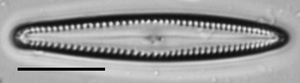 Gomphonema insularum LM1