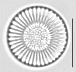 Cyclostephanos dubius LM2