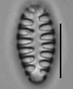 Staurosirella martyi LM8