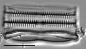 Fragilaria mesolepta LM1
