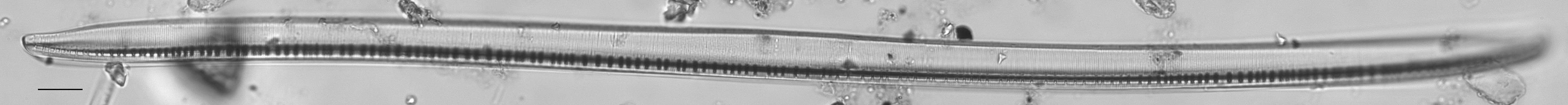 Nitzschia sigmoidea LM1