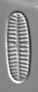 Rossithidium nodosum LM1