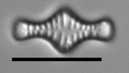 Tabellaria flocculosa LM6