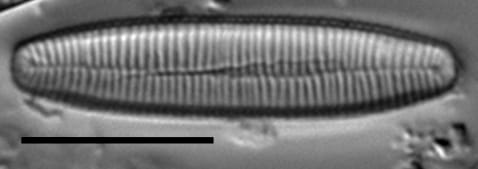 Fragilariforma nitzschioides LM1