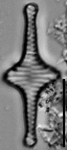 Staurosira stevensonii LM5