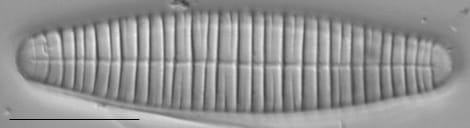 Diatoma vulgaris LM1