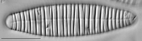 Diatoma vulgaris LM2