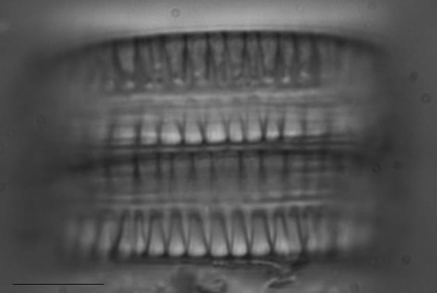 Diatoma vulgaris LM3