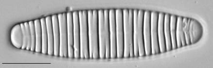 Diatoma vulgaris LM4