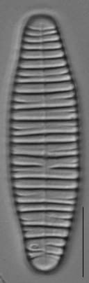 Diatoma vulgaris LM5