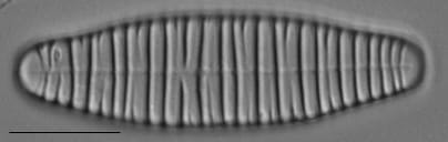 Diatoma vulgaris LM5
