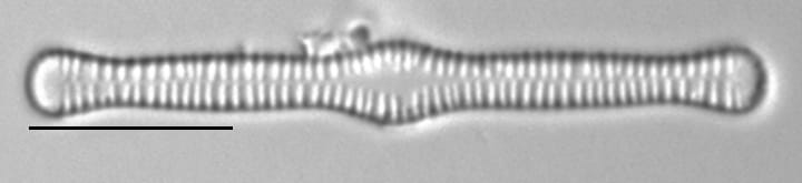 Tabellaria flocculosa LM5