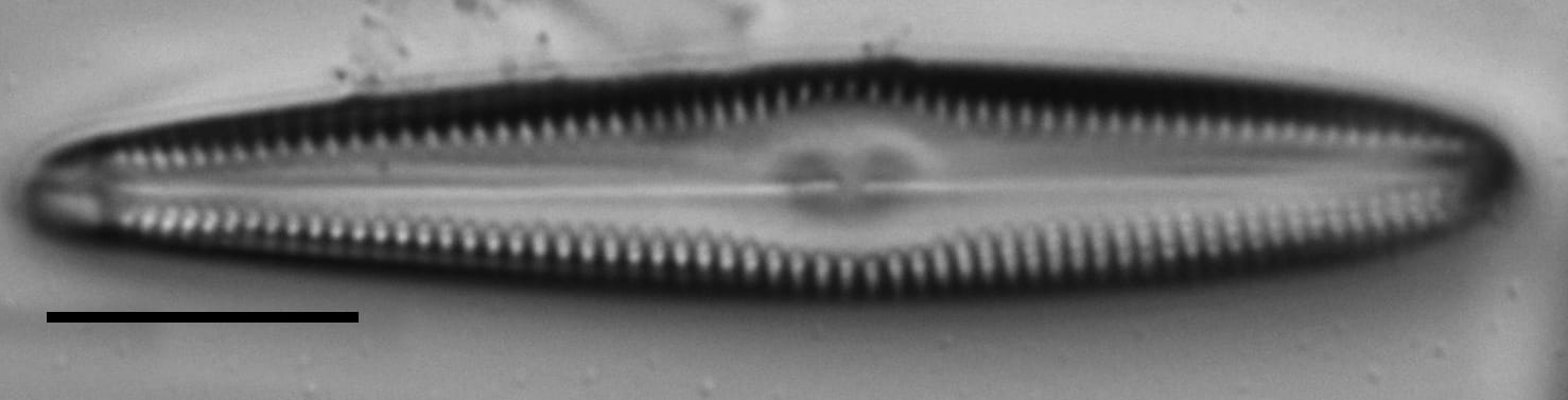 Gomphonema christenseni LM5
