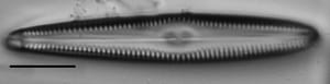 Gomphonema christenseni LM5