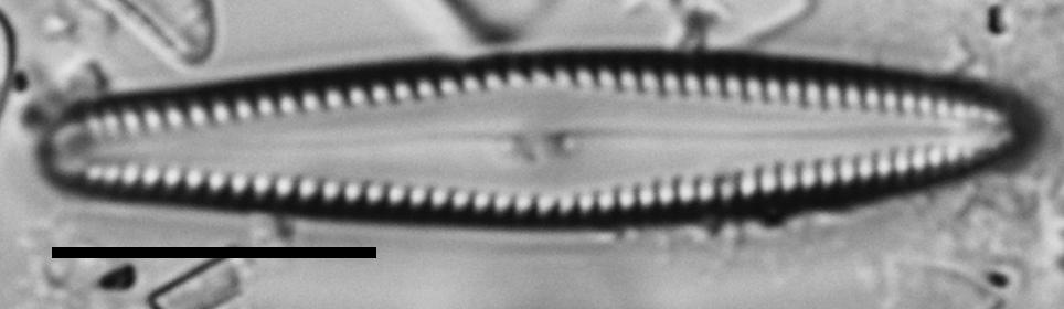 Gomphonema insularum LM2