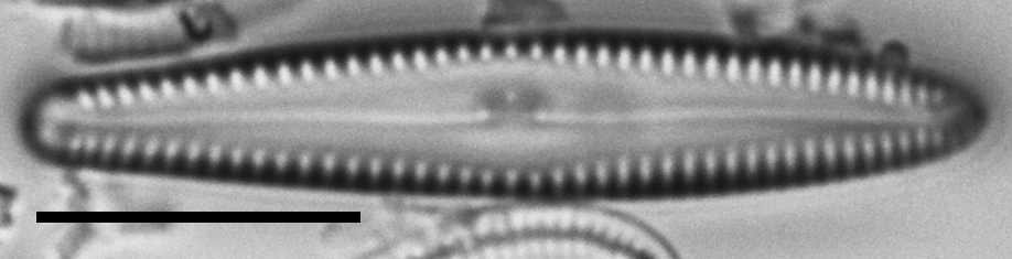 Gomphonema insularum LM3
