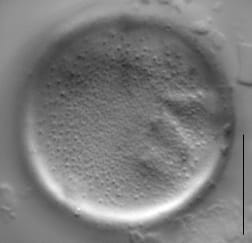 Melosira varians LM6