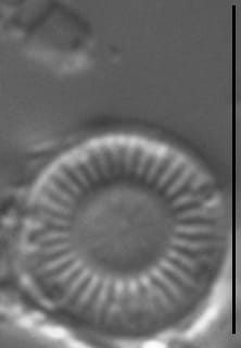 Discostella pseudostelligera LM6