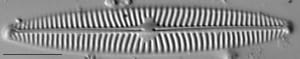 Navicula tripunctata LM6