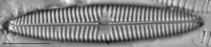 Navicula tripunctata LM10