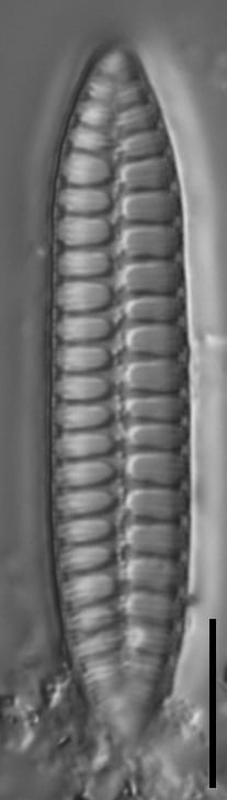 Surirella arctica LM5