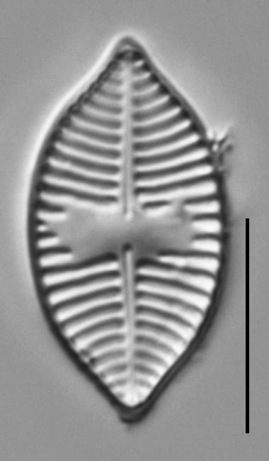 Planothidium lanceolatoide LM5