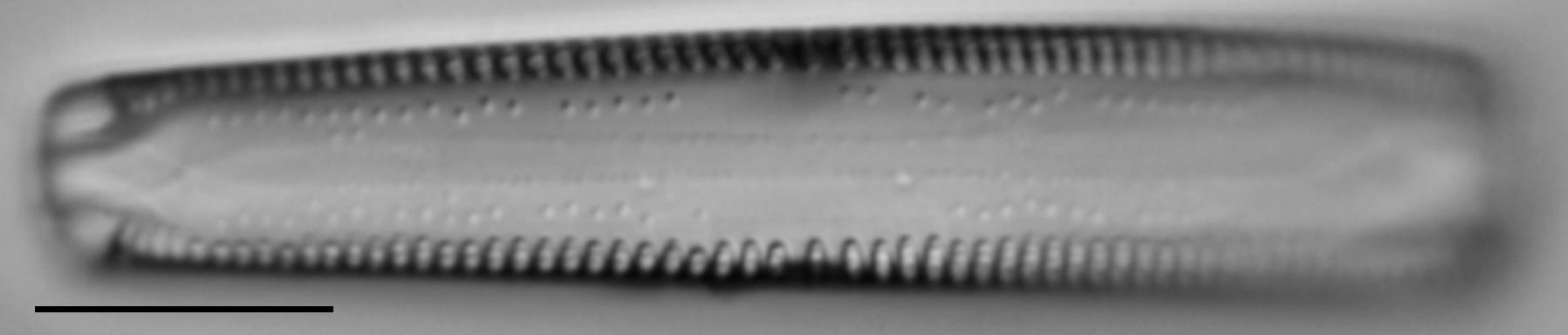 Gomphonema californicum LM1