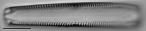 Gomphonema californicum LM1