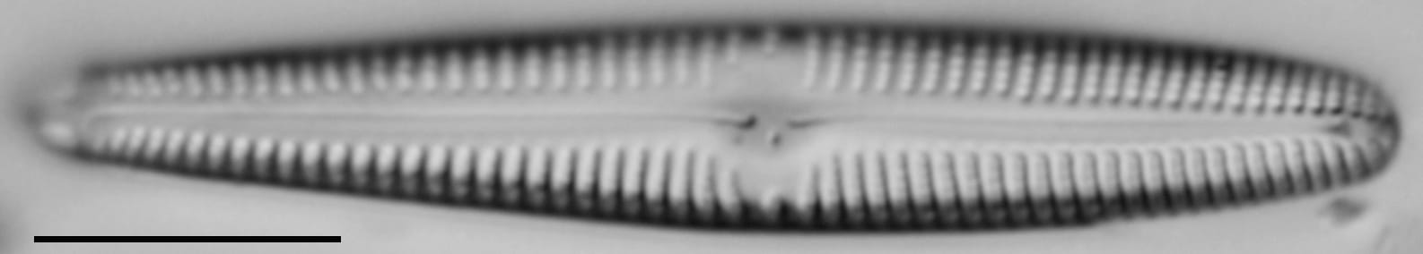 Gomphonema californicum LM2