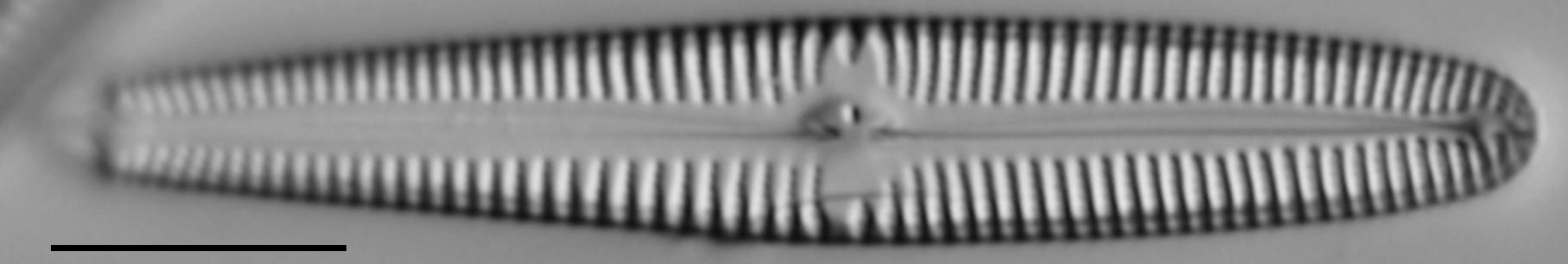 Gomphonema californicum LM3