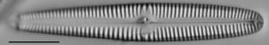 Gomphonema californicum LM3