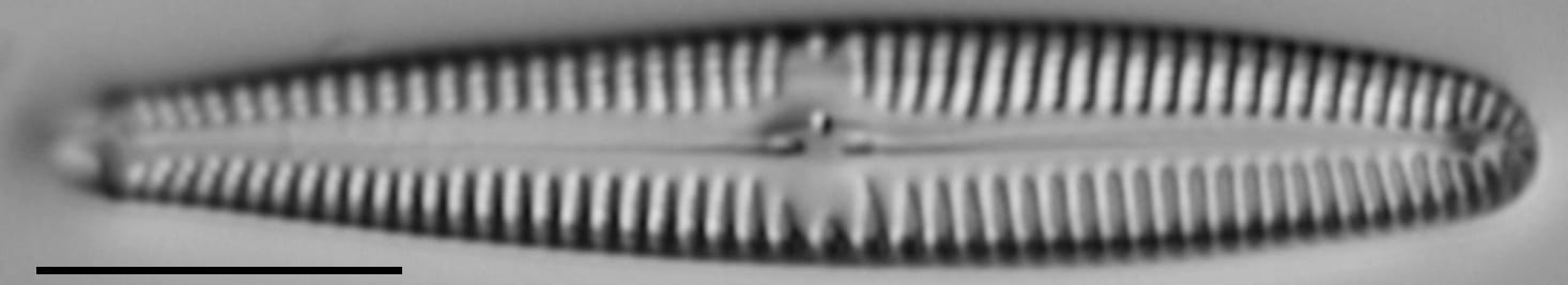 Gomphonema californicum LM5