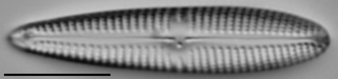 Gomphonema californicum LM6