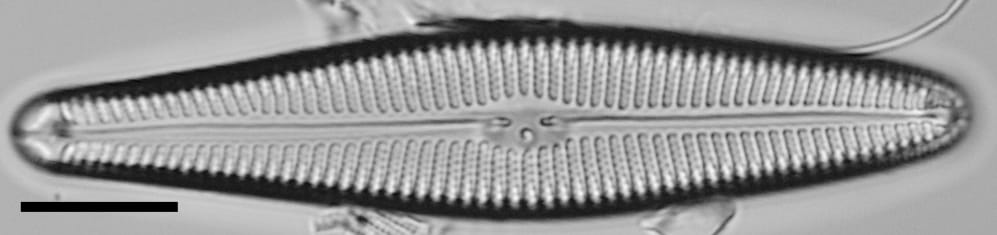 Gomphoneis oreophila LM5