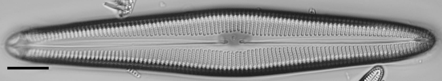 Gomphoneis oreophila LM2