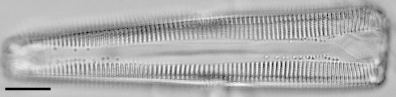 Gomphoneis oreophila LM1