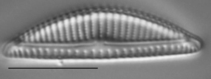 Encyonema minutum LM1