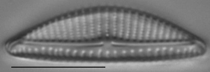 Encyonema minutum LM10