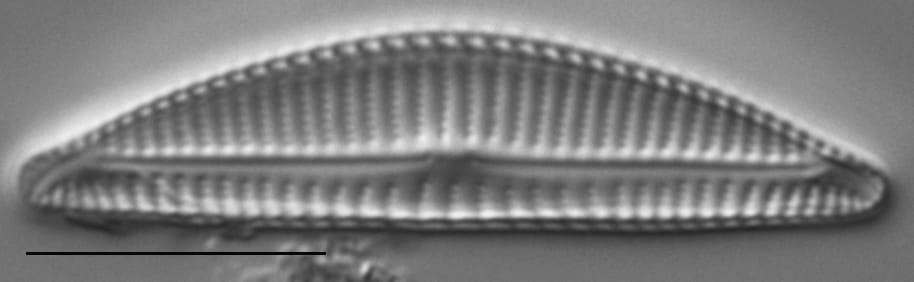 Encyonema minutum LM2