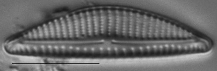 Encyonema minutum LM3