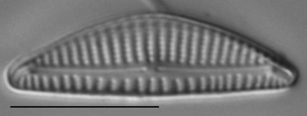 Encyonema minutum LM4