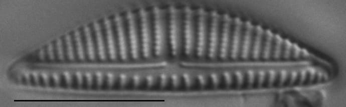 Encyonema minutum LM5