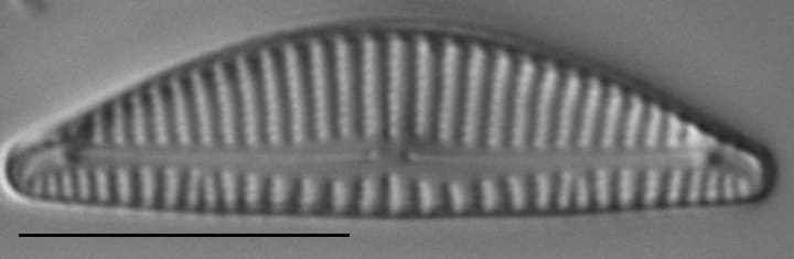 Encyonema minutum LM6