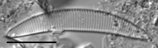 Eunotia sarraceniae LM2