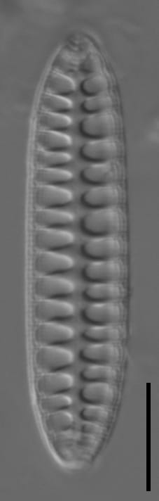 Surirella arctica LM6