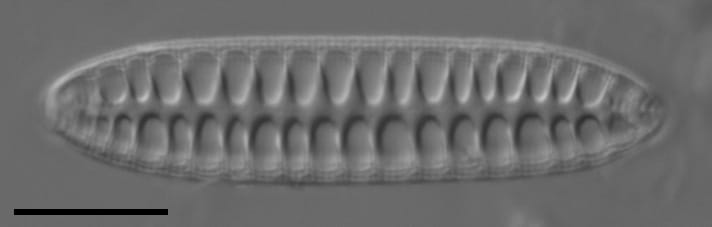 Surirella arctica LM6