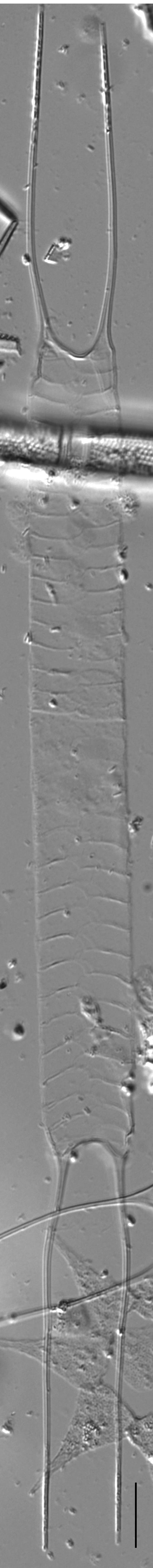 Acanthoceras zachariasii LM6