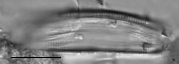 Eunotia sarraceniae LM3